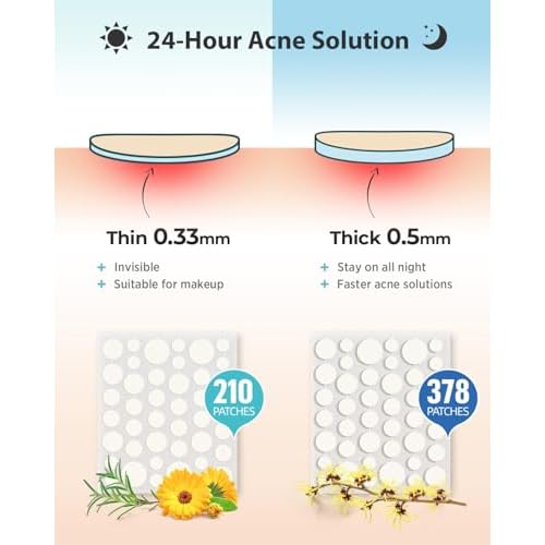 LitBear Acne Pimple Patches- Day and Night 4 Sizes 588 Dots Thin & Thick Hydrocolloid Patches with Witch Hazel, Tea Tree & Calendula Oil, Extra Adhesion for Face Zit Patch Dots