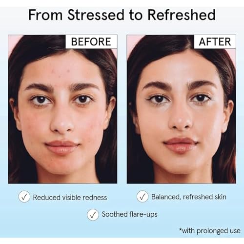 grace & stella Hypochlorous Acid Spray for Face - Body Acne Spray - Gentle Face Mist to Calm Redness & Flare-Ups Back Acne - Soothing Facial Mist for Sensitive Skin - Travel Size (60 ml/2 fl oz)
