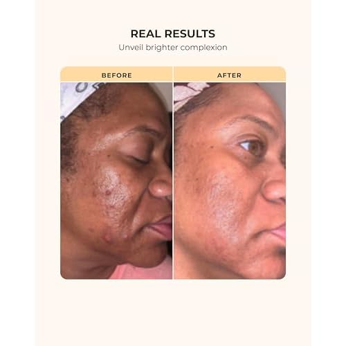 Buttah Skin Transforming Kit for Melanin Rich Skin | CocoShea Revitalizing Cream 2 oz | Vitamin C Serum 1 oz | Buttah Cleanser 3.4 oz | Black Owned Skincare
