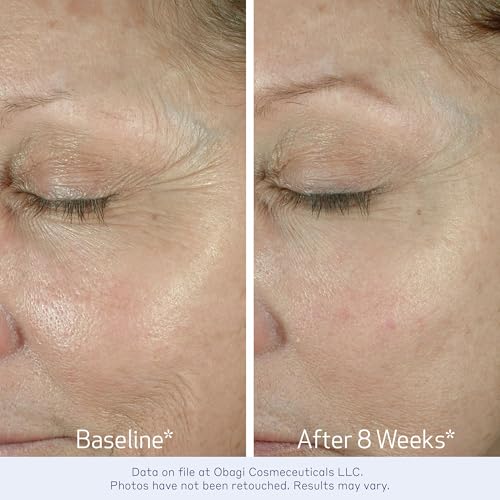Obagi ELASTIderm Eye Cream ? Lightweight, Smooth Formula Clinically Proven to Help Reduce the Appearance of Fine Lines & Wrinkles