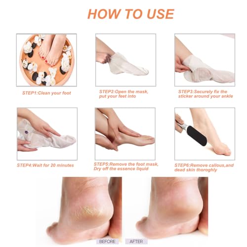 Professional Foot File & Rasp Callus Remover - Remove Hard & Dead Skin, Dual Sided for Wet and Dry Feet (LXX)