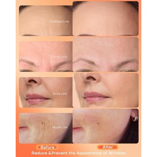 NEWKEY Red Light Therapy Mask for Face,7 Colors LED Face Mask Light Therapy, At-Home Photon Skin Care Beauty Mask for Anti Wrinkles Acne Reduction
