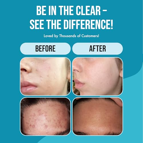 Teenology Body Wash for Teens - Avoid Body Acne and Breakouts - Sulfate and Paraben Free, Natural Botanical Extracts (Fresh Papaya)