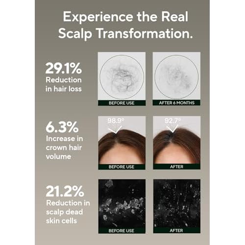AROMATICA Rosemary Salt Scrub Shampoo - Hair Loss Korean Scalp Detox Shampoo with Rosemary Scalp Oil | Scalp Exfoliator with Salt Scrub for Oily Scalp | Sulfate Free, Silicone Free (10.5 oz / 300g)