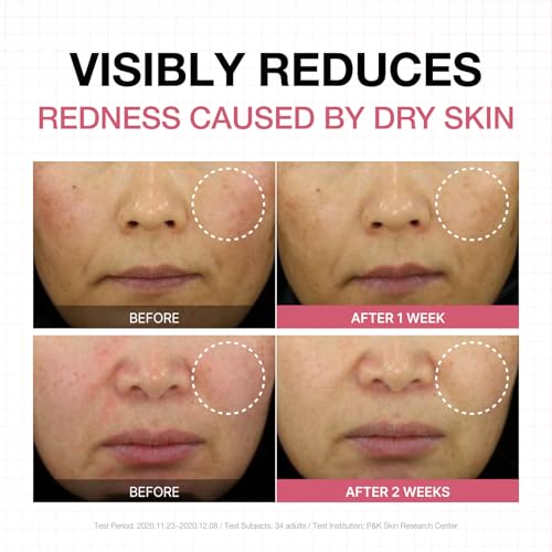 Physiogel Calming Relief Face and Body Lotion, Reduces Redness in just 3 days, Moisturizer for Dry, Red, Itchy, Sensitive Skin, Korean skin care, Fragrance-Free, Non-Comedogenic, Dermatologist-Tested