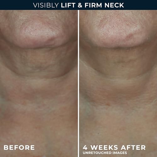 RoC Derm Correxion Neck Cream with Hyaluronic Acid + Advanced Retinol to visibly Tighten & Lift Horizontal Neck Lines, Facial Moisturizer to Contour Face (1.7 oz) with RoC Retinol Eye Packette
