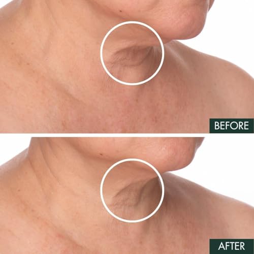 R?Vive Fermitif Neck Renewal Cream - Neck and D?colletage Tightening Cream - Broad Spectrum SPF 15 Sunscreen - Anti-Aging, Reduces Fine Lines & Smooths Skin, 2.5 OZ