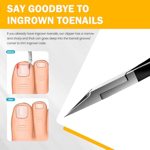 BEZOX Straight Blade Toenail Clippers - Wide Open Pointed Jaw Toe Nail Clippers for Seniors Thick Toenails, Precision Grooming Toenail Scissors for Ingrown Nails - Black