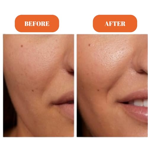 Vitamin C Radiance Serum 30ml ? Inspired by Avon Anew | Brightening & Antioxidant Face Serum with 30 Oranges Worth of Vitamin C | Even Tone, Smooth & Glowing Skin