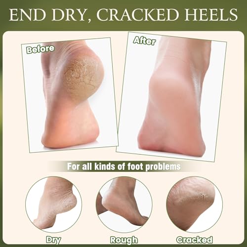 4 Pcs Cracked Heel Repair Set ?Comes with 2 Repair Sticks & 2 Foot Care Socks, Rose & Jojoba Oil Heel Balm for Dry Cracked Feet, No-Mess Applicator, Travel-Friendly