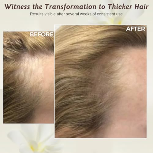 100% Natural Batana Oil for Hair Growth & Repair - Nourishes Scalp, Strengthens Hair, Reduces Breakage Split Ends, For Thicker Looking Hair - 1.76 fl oz