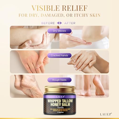 Whipped Tallow Honey Balm Soft Smooth Skin Face 100% Grass-Fed Beef Tallow Body Butter Raw Honey All Skin Type Natural Vanilla Moisturizer for Eczema Rashes Dry Skin Sunburn Stocking Stuffer for Women
