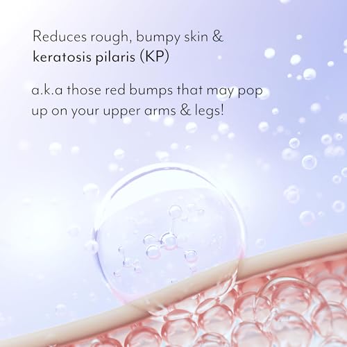 Bliss Body Butter Texture Takedown Skin Smoothing Lotion - Keratosis Pilaris KP - 6.7 Fl Oz - For Rough, Bumpy Skin - 10% AHA + Squalane + Shea Butter - Clean - Vegan & Cruelty-Free