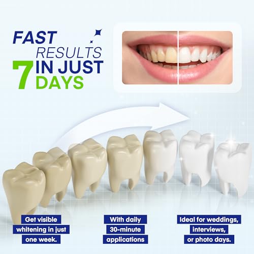Teeth Whitening Pen ? 35% Urea Peroxide Gel, Clear Twist-Dispensing Whitening Pens for Stain Removal, Professional-Strength, Easy-to-Use, Travel-Friendly(A Set of 5 Pens)