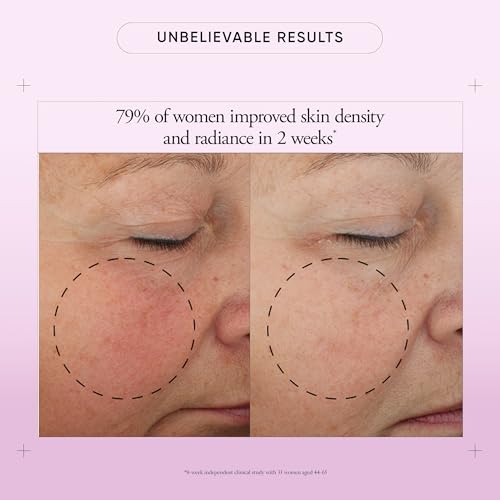 philosophy ultimate miracle worker multi-rejuvenating face moisturizer cream + spf 30 - with encapsulated retinol - delivers firmer, youthful looking & radiant skin without irritation - 2 fl oz