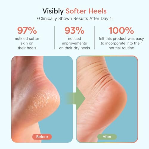 ZenToes Moisturizing Socks for Cracked Heel Treatment, Vitamin E, Olive Oil and Jojoba Oil Heel Socks, Stocking Stuffers for Women, Spa Self Care Gifts for Women (Fuzzy Blue, Regular)