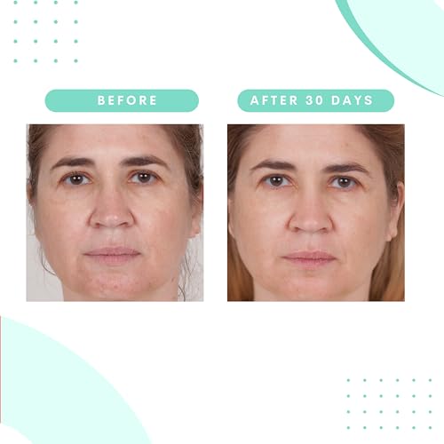 Serious Skincare Glycolic Acid Serum & Face Moisturizer Cream, Facial Renewal Skin Care Set, Exfoliating, Hydrating, Refine Texture, Lines, Pores, Discoloration, Skin Balancing Blue Tansy - Anti-Aging