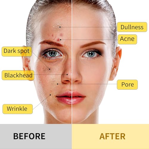 Turmeric Vitamin C Clay Mask with Kaolin Clay and Turmeric for Dark Spots, Dull Skin, Skincare Facial Mask for Controlling Oil and Refining Pores 5.29 Oz (yellow)