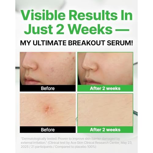 Trouble Targeting Serum, Hydrating & Balancing Face Serum with Niacinamide, Hyaluronic Complex & Tea Tree Biome for Oily Sensitive Blemish-Prone Skin, Korean Skincare (30ml / 1.01 fl.oz.)