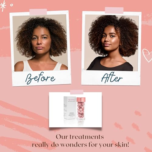 TURBINNE Pure 2.5% Retinol Serum Capsules. Look 5 Years Younger In Just 30 Days. Powerful Anti -Aging, Deep Hydration, Brightening, Reduce Wrinkles, Acne Scars, Dark Spots. Complete Skincare Capsules