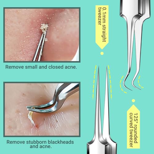 TsMADDTs Blackhead Remover Tools and Ingrown Hair Tweezers, 9PCS Pimple Popper Tool Kit, Ingrown Hair Removal Kit with Pimple Extractor, Pore Extractor, Tweezers, Razor