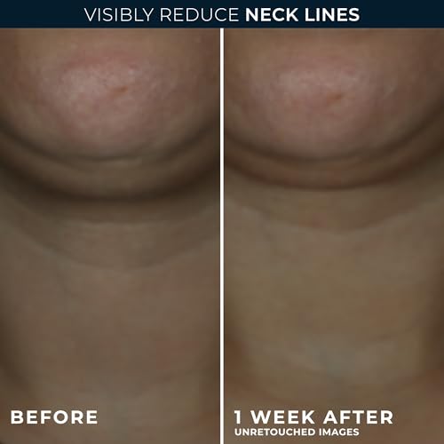 RoC Derm Correxion Neck Cream with Hyaluronic Acid + Advanced Retinol to visibly Tighten & Lift Horizontal Neck Lines, Facial Moisturizer to Contour Face (1.7 oz) with RoC Retinol Eye Packette