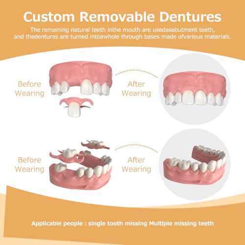 Partial Dentures - Dentures for Missing Teeth & Gaps - Lightweight & Unbreakable Replacement Teeth for Men & Women (2 Teeth)
