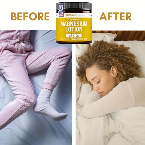 Nighttime Magnesium Lotion with Arnica ? Soothing Relief & Relaxation, Highly Concentrated Magnesium for Muscles & Joints ? Apply to Legs or Feet Before Bed ? Skin-Friendly