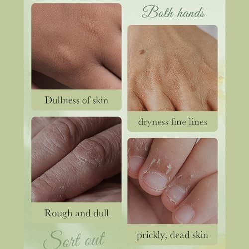 Hand Masks for Dry Cracked Hands - 6 Pairs Avocado Intensive Lotion Moisturizing Gloves - Hydrating Exfoliating Glove Repair Rough Skin - Deep Moisture Spa Hand Masks to Remove Dead Skin Nourishing