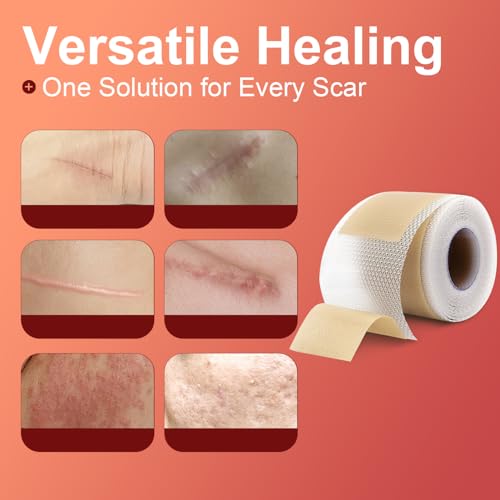 Silicone Scar Sheets (1.6¡±x 60¡± Roll-1.5M), Medical Grade Silicone Scar Tape Roll, Reusable Silicone Scar Strip, Professional Scar Removal Sheets for Surgery, C-Section, Burn, Keloid, Acne Etc