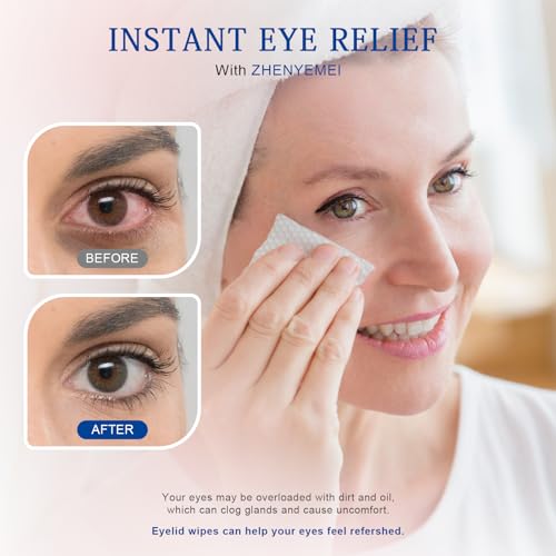 Tea Tree Oil Eyelid Cleansing Wipes, 60 Individually Wrapped Travel Eyelid Wipes With Physiological Saline - Cleanser & Eye Makeup Remover for Dry Eyes, Stye, Blepharitis Treatment