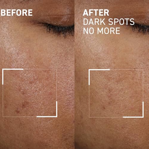 Dr. Brandt Bright This Way Dark Spots No More - 0.5 fl oz, Pack of 2 - Reduces Number, Intensity & Size of Pigmented Spots