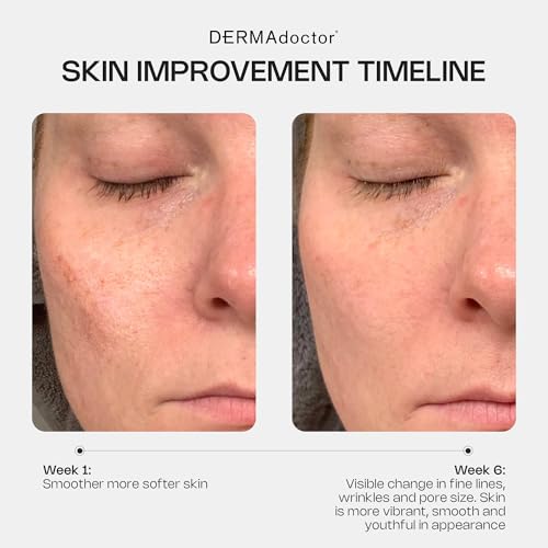 DERMAdoctor Retinol Cream for Face - Stabilized Vitamin C, Vitamin E, Ferulic Acid Anti Aging Face Cream 1% Retinol Facial Moisturizer Night-Cream for Dullness, Discoloration, Fine Lines, & Wrinkles