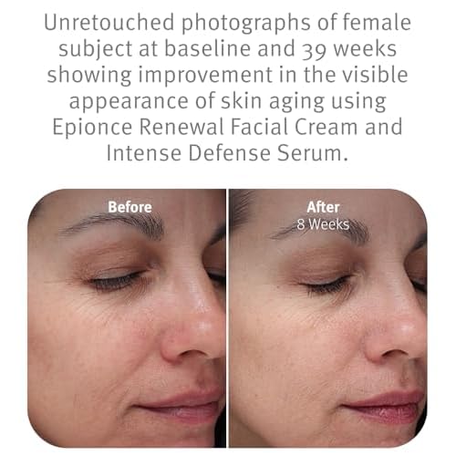 Epionce Renewal Facial Cream ? Hydrating Anti-Aging Moisturizer | For Dry, Sensitive to Normal Skin | Fine Lines & Wrinkles | Dermatologist Skincare