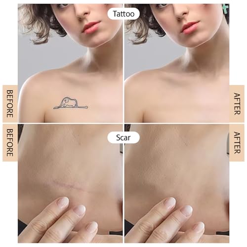 DAGEDA 8Pcs Tattoo Cover Up Patch,Natural Looking Cover up Tattoos and Scar,Tattoo Cover Up Tape, Invisible Waterproof Body Concealer Makeup Sticker-Natural