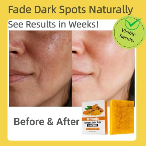 Lemon Turmeric & Kojic Acid Soap Bar For Dark Spot ? lightening Skin with Vitamin C - 3x Moisturizing with Shea Butter for Face / Body?Natural ingredien Glowing Soap for Oily & Dry Care - 3 Pcs