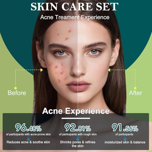 Skin Care Set,Acne Treatment for Face Skin Care Sets & Kits,Tea Tree Essential Oil Facial Skincare Gift Set with Cleanser,Toner,Serum,Gel, Acne Treatment Kit Cream Skin Care for Teens 10-12 Girls Boys