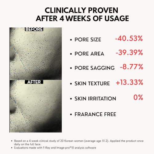 Superface 24K Golden Alchemy Micro?Spicule Cream - Anti?Aging Microneedling Face Treatment for Women & Men with 24K Gold, Cica, Peptides & Retinal, Targets Skin Texture & Pores, 30ml / 1oz