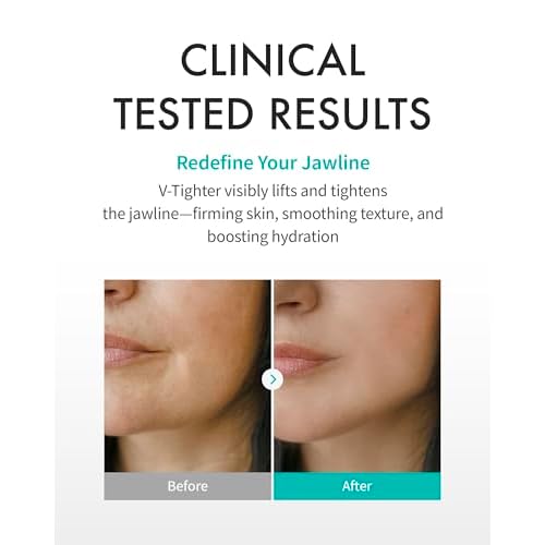 REJURAN¢ç Perfect V Tighter Dual-Sheet Lifting Sheet Mask, c-PDRN¢ç (4ea) ? Face & Jawline Lifting and Firming Original PDRN & Purecolla, Deep Moisturizing, Skin Tightening Anti-Aging Korean Skin Care