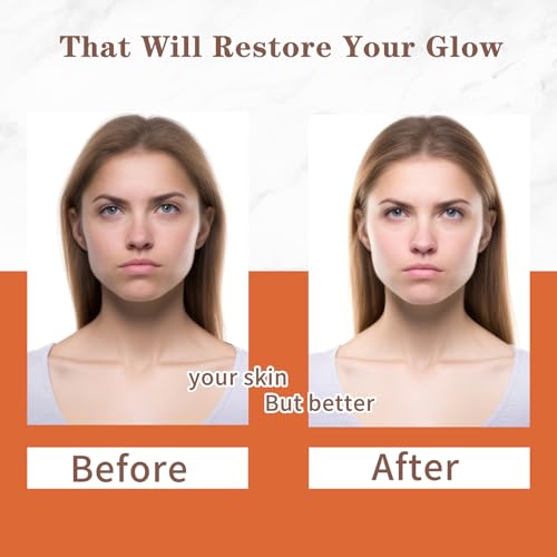 EUQEE Glutathione Kojic Acid Soap, 5 oz Glutathione Soap Bars with Glutathione, Vitamin C, Collagen for Rejuvenating Skin, Reduces the Appearance of Dark Spots Fine Lines with a Foaming Net- 2 x 142g