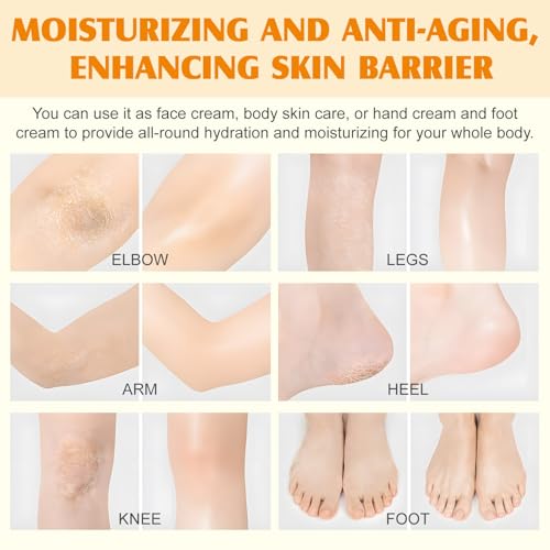 Grass-Fed Tallow & Raw Honey Balm | Whipped Skin Cream for Face & Body | Soothes & Repairs Dry, Sensitive Skin | Organic, All-Natural Deep Hydration (2.1 oz)