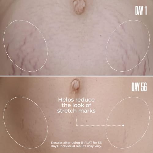 MA?LYS Cosmetics B-FLAT Belly Firming Cream - Stretch Mark, Tightening Belly Cream
