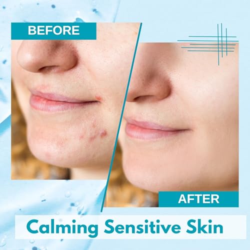 Lululun 28EA Hydrating Face Mask for Acne-Prone Skin & Sensitive Skin, Natural Face Mask for Women & Men with Azelaic Acid & Bifida Ferment, Daily Facial Mask Sheet & Sheet Mask from Japan, Hydra-AZ