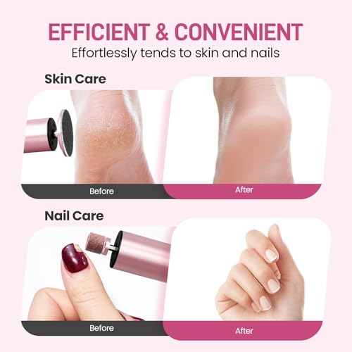 Electric Foot Callus Remover, 2 in 1 | 6 Speed Adjustable Foot File Nail Grinder with Sandpaper Disks, Professional Pedicure Tool for Feet Dead Skin, Self Care Gifts for Women Mom Lover Friends (Pink)
