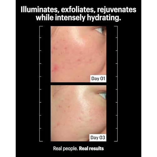 Allies of Skin Multi Acids & Retinoid Sleeping Facial | Exfoliating Overnight Glycolic Acid & AHA Peel | Resurfacing Anti-Aging Treatment For Fine Lines | Unclog Pores and Treat Blackheads 1.6 fl oz