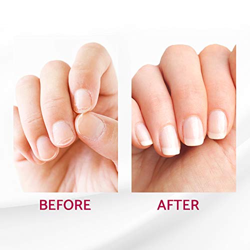 IBD Reconstrux Nail Repair Treatment ? Nail Strengthener for Weak & Damaged Nails, Nail Growth Treatment for Peeling & Brittle Nails ? 0.125 fl oz, 2 Pack