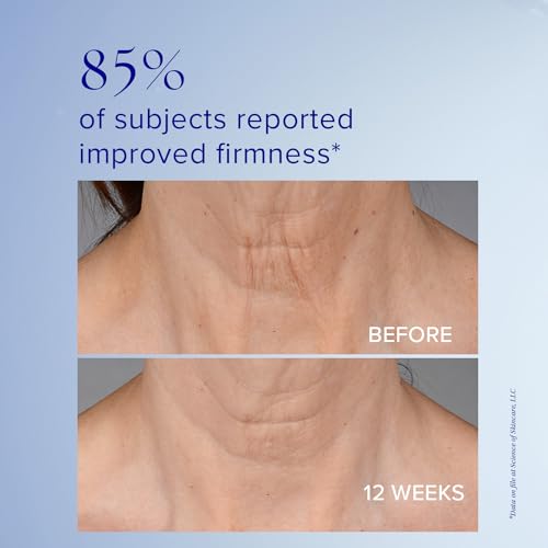 iS CLINICAL Neckperfect Complex, Neck Firming Cream, Anti-Aging Neck Lift, Neck Tightening Cream