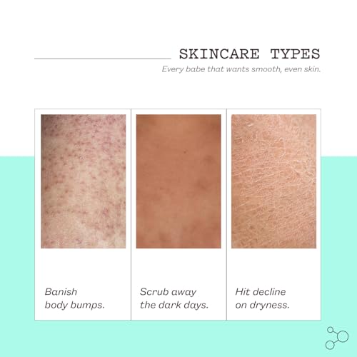 frank body Glycolic Acid Body Scrub | Fights KP & Breakouts, Spots & Tighten Pores | Reduces Acne with Niacinamide & Soothes with Witch Hazel | Glycolic Acid & Pumice | 8.82 oz | Pack of 1