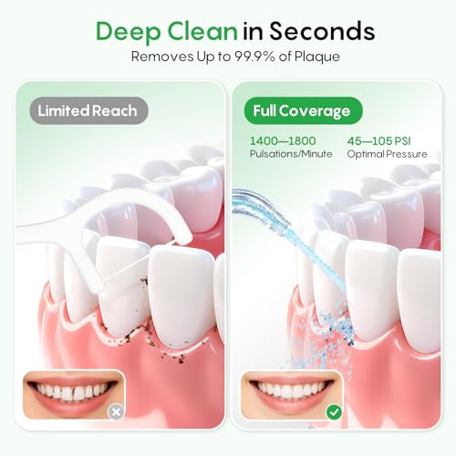 FRESKO Water Flosser with High Pulse & Constant Pressure Tech, Rechargable Oral Irrigator wih 10oz Water Tank, 50 Days Long-Lasting, IPX7, 4 Modes & 5 Tips for Travel