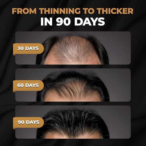 SPARTAN¢â Root Activator Shampoo For Men - Hair Growth Shampoo for Hair Loss and Thinning Hair